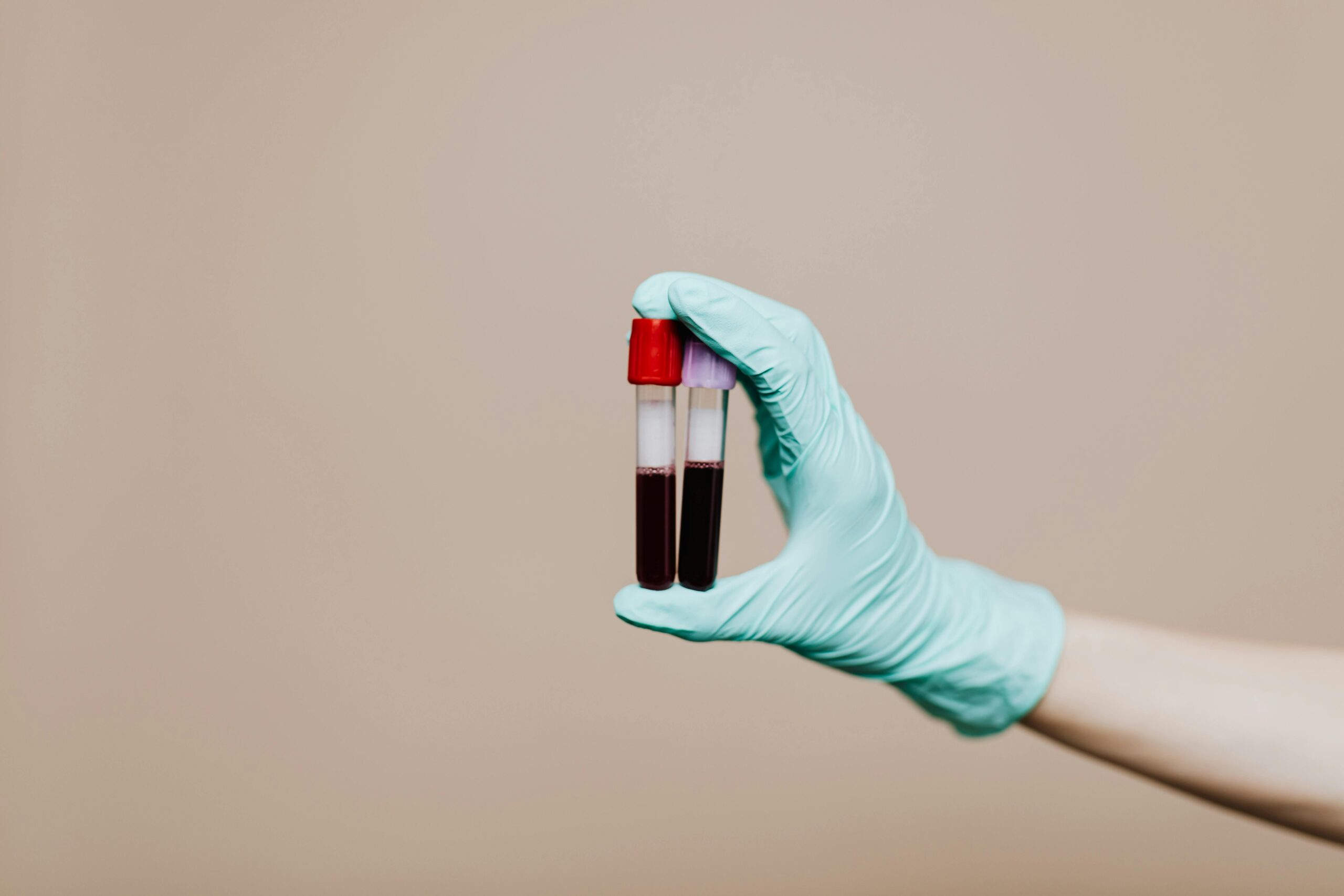 person holding Test tubes of blood
