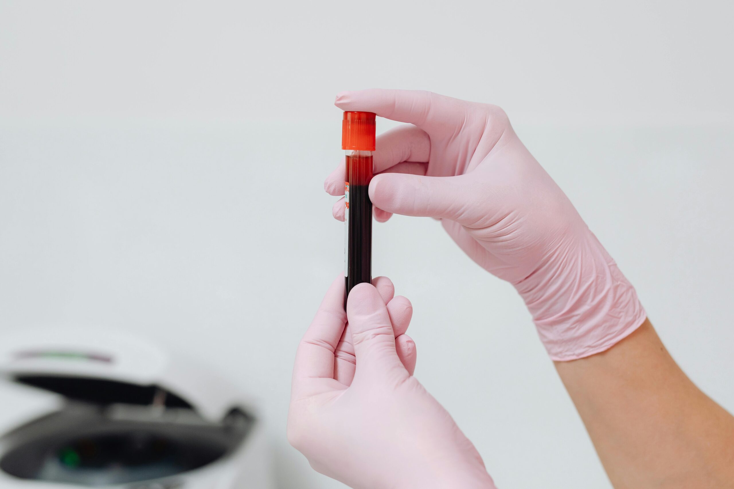 blood in test tube